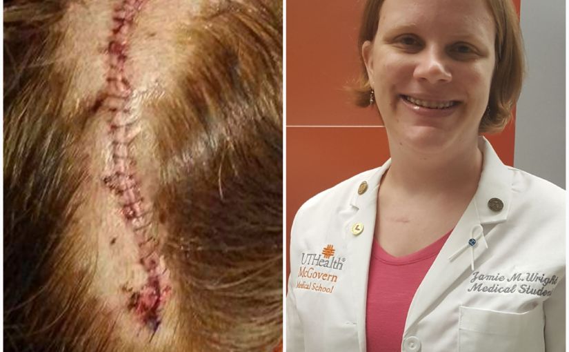 See how this woman living with hydrocephalus still reaches for her dreams to become a doctor, no matter&nbsp;what!